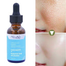 Lactic Acid Solution Essence Hyaluronic Acid Exfoliating Moisturizing Facial Essence Lactic Acid