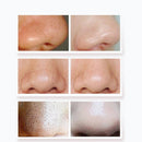 Electric Blackhead Suction Remover 2 Gears Vacuum Acne Pore Cleaner USB Charging Face Nose Skin Care with 3 Heads
