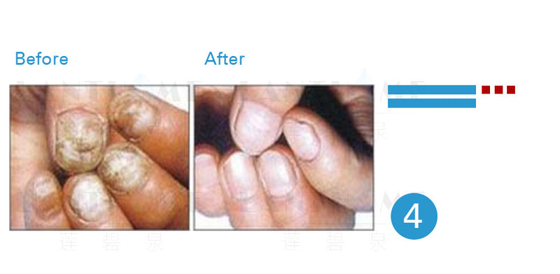 Lian Biquan Nail Repair Nail Polish Repair