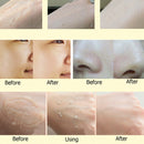 Laikou Exfoliator Cream Scrub Cutin Facial Exfoliating Moisturizing Body Dead Skin Removal Gel