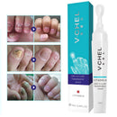 Fungal Nail Treatment Pen Essence Foot Whitening Toe Nail Fungus Removal Feet Care