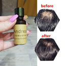 2Pcs/1Set 20ml Andrea Hair Growth Essence Hair Loss Liquid Dense Hair