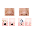 Electric Absorbing Blackhead Pore Cleanser Skin Care Acne Suction Remover Facial Care Device Tool