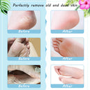 Skymore Foot Peel Mask Exfoliating Callus Peeling Off Calluses & Dead Skin