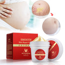Women Smooth Skin Cream Scar Removal Skin Body Stretch Mark Repair Cream Beauty Care