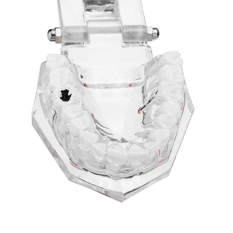 Clear Dental Teeth Study Teaching Model Crystal Typodont Model Removable Teeth Model Medical Model
