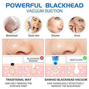 Blackhead Remover Pore Vacuum - Facial Pore Cleanser Electric Acne Comedone