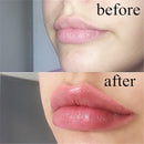 Automatic Lips Plumper Electric Plumping Device Beauty Tool Fuller Bigger Thicker Lips