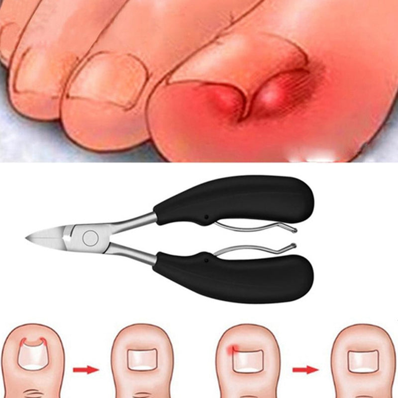 New Toe Nail Clippers 2Pc Nail Correction Nippers Clipper Cutters Dead Skin M3C9