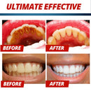 Strengthening Stain Removal Gel Toothpaste Whitening Toothpaste Fight Bleed