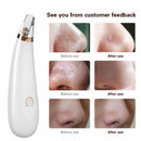 Face Nose Acne Blackhead Removal Blackhead Vacuum Cleaner Pores Blackhead S
