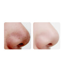 Electric Blackhead Acne Suction Remover USB Rechargeable 3 Levels Pore Vacuum Cleaner Skin Face Cleanser with 4 Heads