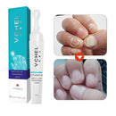 Fungal Nail Treatment Pen Essence Foot Whitening Toe Nail Fungus Removal Feet Care