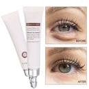 20g Best Eye Cream Serum For Dark Circles Puffiness Under Eye Reduce Fine