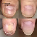 Ke Xunzhi Extract Nail Repair Cream Moisturizer Cream