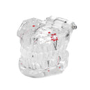 Clear Dental Teeth Study Teaching Model Crystal Typodont Model Removable Teeth Model Medical Model