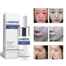 LANBENA Hyaluronic Acid Serum Snail Essence Moisturizing Acne Treatment Repair Anti-Aning Winkles