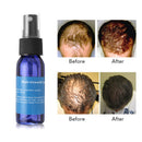 Okeny's Brand Yuda Pilatory Stop HairLoss Fast Hair Growth Spray Liquid Hair Essence