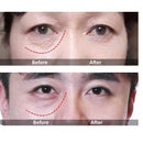 Eye Delight Boost Serum Essence Anti Puffiness Dark Circle Wrinkle Remover Cream