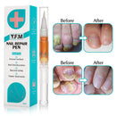 Y.F.M 3ml Toenail Onychomycosis Curing Pen Fungus Removal Fungus Treatment