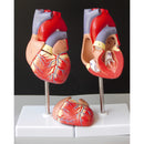 Life Size Human Heart Model Anatomical Cardiac Model Learning Lab Supplies Medical Model