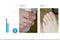 Lian Biquan Nail Repair Nail Polish Repair