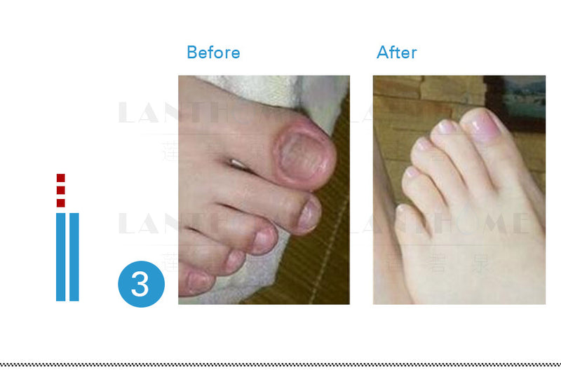 Lian Biquan Nail Repair Nail Polish Repair