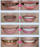 3ml Teeth Whitening Gel Peroxide Bleaching System Oral Dental Care Equipment Tooth Whitener Supplies