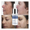 LANBENA Hyaluronic Acid Serum Snail Essence Moisturizing Acne Treatment Repair Anti-Aning Winkles