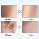 10ml Hair Growth Inhibitor Essence After Hair Removal Cream Repair Liquid Essence Skin Repairing