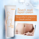 Rosalind Dilute Scar Acne Scars Stretch Marks To Stretch Marks Cream