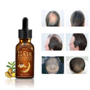 30ml Hair Growth Liquid Hair Strengthen Hair Root Nutrient Solution Hair Regeneration Essence