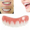 Cosmetic Buckle Perfect Smile Comfortable Fit Elastic Braces