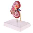 2-Sided Kidney Anatomical Model with Stand Nephropathy Statue Human Organ Learning Tool Lab Supply Science Educational Toy