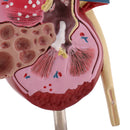 2-Sided Kidney Anatomical Model with Stand Nephropathy Statue Human Organ Learning Tool Lab Supply Science Educational Toy