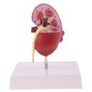 2-Sided Kidney Anatomical Model with Stand Nephropathy Statue Human Organ Learning Tool Lab Supply Science Educational Toy