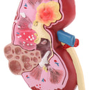 2-Sided Kidney Anatomical Model with Stand Nephropathy Statue Human Organ Learning Tool Lab Supply Science Educational Toy