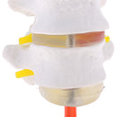 Lab Supplies 1:1 Human Spine Lumbar Vertebra with Diseased Intervertebral Disc Model School Teaching Display