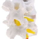 Lab Supplies 1:1 Human Spine Lumbar Vertebra with Diseased Intervertebral Disc Model School Teaching Display
