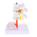 Lab Supplies 1:1 Human Spine Lumbar Vertebra with Diseased Intervertebral Disc Model School Teaching Display