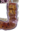1:2 Human Large Intestine Pathology Strudy Model Educative Tool Lab Supplies