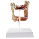 1:2 Human Large Intestine Pathology Strudy Model Educative Tool Lab Supplies