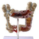 1:2 Human Large Intestine Pathology Strudy Model Educative Tool Lab Supplies