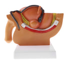 1:2 Sagittal Section Of Human Male Pelvis Testicle Prostate Structure Model School Teaching Display Kits