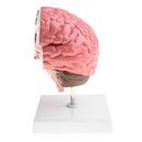 Minification 1X Human Brain Brainstem Cerebral Hemorrhage Diseased Pathological Model Teaching Model
