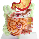 Minification 1X Human Large Intestine Stomach Pathological Model School Teaching Display Lab Supplies