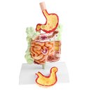 Minification 1X Human Large Intestine Stomach Pathological Model School Teaching Display Lab Supplies
