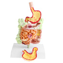 Minification 1X Human Large Intestine Stomach Pathological Model School Teaching Display Lab Supplies