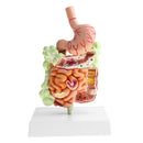 Minification 1X Human Large Intestine Stomach Pathological Model School Teaching Display Lab Supplies