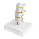 1:1 Human 4 Lumbar Vertebrae Intervertebral Disc Skeleton Model School Teaching Display Lab Supplies